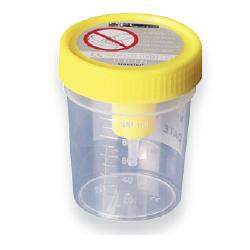 Medipresteril Contenitore Urina Sterile Sistema Transfert, 1 Pezzo