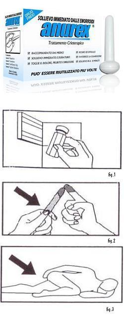 Anurex crioterapia emorroidi